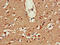 ATPase Phospholipid Transporting 9A (Putative) antibody, CSB-PA002422LA01HU, Cusabio, Immunohistochemistry paraffin image 
