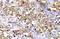 Serine-protein kinase ATM antibody, AP20965PU-N, Origene, Immunohistochemistry frozen image 