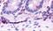 Hepatocyte Nuclear Factor 4 Gamma antibody, PA5-33840, Invitrogen Antibodies, Immunohistochemistry paraffin image 