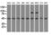 LEM Domain Containing 3 antibody, M04957, Boster Biological Technology, Western Blot image 