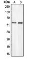 Carbohydrate Sulfotransferase 2 antibody, LS-C353165, Lifespan Biosciences, Western Blot image 