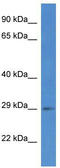 SPRY domain-containing SOCS box protein 2 antibody, TA343001, Origene, Western Blot image 