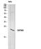 CKLF Like MARVEL Transmembrane Domain Containing 8 antibody, STJ97681, St John