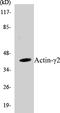 Actin Gamma 2, Smooth Muscle antibody, EKC1015, Boster Biological Technology, Western Blot image 