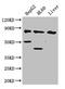 6-phosphofructokinase, liver type antibody, CSB-PA017821LA01HU, Cusabio, Western Blot image 