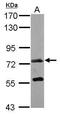 Polypeptide N-Acetylgalactosaminyltransferase 7 antibody, PA5-31458, Invitrogen Antibodies, Western Blot image 