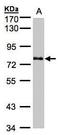 Polypeptide N-acetylgalactosaminyltransferase 6 antibody, GTX104602, GeneTex, Western Blot image 