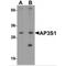 AP-3 complex subunit sigma-1 antibody, MBS151516, MyBioSource, Western Blot image 