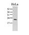 Peptidylprolyl Isomerase C antibody, AM39042PU-N, Origene, Western Blot image 