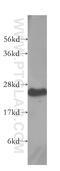 Biogenesis Of Lysosomal Organelles Complex 1 Subunit 6 antibody, 10891-2-AP, Proteintech Group, Western Blot image 