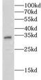 Ceroid-lipofuscinosis neuronal protein 6 antibody, FNab01768, FineTest, Western Blot image 
