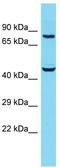 Sushi Domain Containing 5 antibody, TA331944, Origene, Western Blot image 