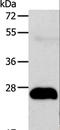 1-Acylglycerol-3-Phosphate O-Acyltransferase 2 antibody, LS-C402605, Lifespan Biosciences, Western Blot image 