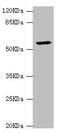 Dihydropyrimidinase antibody, LS-C675657, Lifespan Biosciences, Western Blot image 