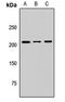 Myotubularin-related protein 5 antibody, LS-C668274, Lifespan Biosciences, Western Blot image 