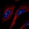 NOP53 Ribosome Biogenesis Factor antibody, NBP2-56742, Novus Biologicals, Immunocytochemistry image 