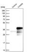 Charged Multivesicular Body Protein 6 antibody, NBP1-83726, Novus Biologicals, Western Blot image 