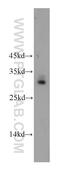 Cilia And Flagella Associated Protein 300 antibody, 20780-1-AP, Proteintech Group, Western Blot image 