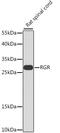 Retinal G Protein Coupled Receptor antibody, GTX32837, GeneTex, Western Blot image 