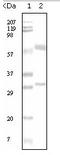 Estrogen Receptor 1 antibody, AM06108PU-N, Origene, Western Blot image 