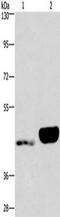 Ectonucleotide Pyrophosphatase/Phosphodiesterase 4 antibody, TA351158, Origene, Western Blot image 