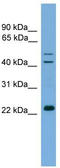 Cysteine And Histidine Rich Domain Containing 1 antibody, TA340165, Origene, Western Blot image 