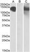 Cadherin 11 antibody, TA311215, Origene, Western Blot image 