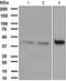 Death Associated Protein Kinase 2 antibody, TA307795, Origene, Western Blot image 