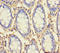 Rhomboid Like 2 antibody, A54699-100, Epigentek, Immunohistochemistry paraffin image 