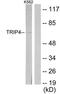 Thyroid Hormone Receptor Interactor 4 antibody, TA314894, Origene, Western Blot image 