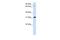 Uridine Phosphorylase 1 antibody, PA5-42112, Invitrogen Antibodies, Western Blot image 
