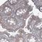 AarF Domain Containing Kinase 1 antibody, HPA051012, Atlas Antibodies, Immunohistochemistry frozen image 
