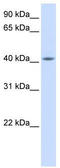Mitochondrial Fission Regulator 2 antibody, TA339992, Origene, Western Blot image 
