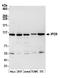 Importin-9 antibody, A305-474A, Bethyl Labs, Western Blot image 