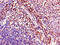 Acyl-CoA Dehydrogenase Family Member 8 antibody, CSB-PA892457LA01HU, Cusabio, Immunohistochemistry paraffin image 