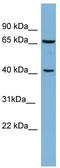 DNA Polymerase Beta antibody, TA337689, Origene, Western Blot image 