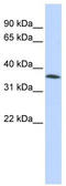 Zinc Finger C2HC-Type Containing 1A antibody, TA329896, Origene, Western Blot image 