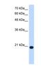 Ubiquitously Expressed Prefoldin Like Chaperone antibody, NBP1-54826, Novus Biologicals, Western Blot image 