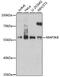 Mitogen-activated protein kinase kinase kinase 8 antibody, GTX02525, GeneTex, Western Blot image 