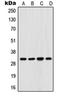 Four And A Half LIM Domains 3 antibody, orb213934, Biorbyt, Western Blot image 