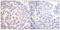 Anaphase Promoting Complex Subunit 1 antibody, LS-C198634, Lifespan Biosciences, Immunohistochemistry paraffin image 