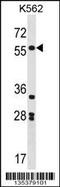 SRY-Box 11 antibody, 58-294, ProSci, Western Blot image 