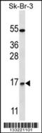 NOTCH Regulated Ankyrin Repeat Protein antibody, 57-169, ProSci, Western Blot image 