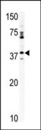 Cyclin Dependent Kinase 20 antibody, 62-673, ProSci, Western Blot image 