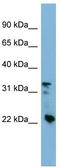 Crystallin Beta B3 antibody, TA340043, Origene, Western Blot image 