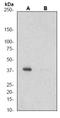CRK Like Proto-Oncogene, Adaptor Protein antibody, TA303464, Origene, Western Blot image 