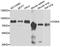 Diacylglycerol Kinase Alpha antibody, A6896, ABclonal Technology, Western Blot image 