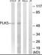 Serine/threonine-protein kinase PLK5 antibody, PA5-39441, Invitrogen Antibodies, Western Blot image 