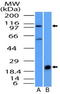 NLR Family Pyrin Domain Containing 6 antibody, TA337214, Origene, Western Blot image 