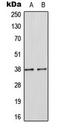 Suppressor Of Cytokine Signaling 1 antibody, LS-C354123, Lifespan Biosciences, Western Blot image 